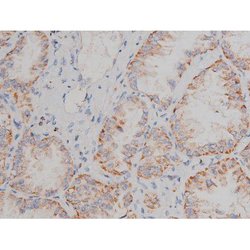 Invitrogen Phospho-Alpha-synuclein (Ser129) Polyclonal Antibody 100 &mu;L;