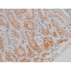 Invitrogen Phospho-Alpha-synuclein (Ser129) Polyclonal Antibody 100 &mu;L;