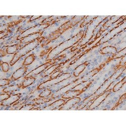Invitrogen Phospho-Alpha-synuclein (Ser129) Polyclonal Antibody 100 &mu;L;