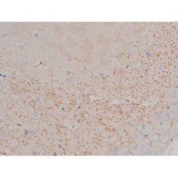 Invitrogen Phospho-Alpha-synuclein (Ser129) Polyclonal Antibody 100 &mu;L;