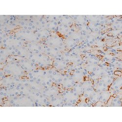 Invitrogen Phospho-Alpha-synuclein (Ser129) Polyclonal Antibody 100 &mu;L;