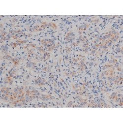 Invitrogen Phospho-Alpha-synuclein (Ser129) Polyclonal Antibody 100 &mu;L;