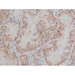 Invitrogen Phospho-Alpha-synuclein (Ser129) Polyclonal Antibody 100 &mu;L;