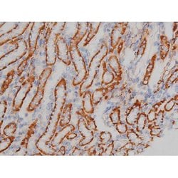 Invitrogen Phospho-Alpha-synuclein (Ser129) Polyclonal Antibody 100 &mu;L;