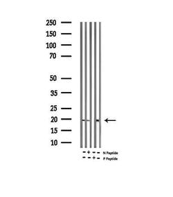 Invitrogen Phospho-Alpha-synuclein (Ser129) Polyclonal Antibody 100 &mu;L;
