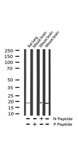 Invitrogen Phospho-Alpha-synuclein (Tyr133) Polyclonal Antibody 100 &mu;L | Buy Online | Invitrogen&trade; | Fisher Scientific