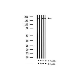 Invitrogen Phospho-BRCA1 (Ser1423) Polyclonal Antibody 100 &mu;L | Buy Online | Invitrogen&trade; | Fisher Scientific