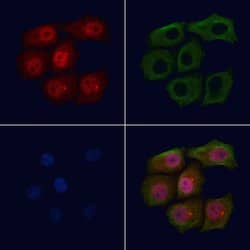 Invitrogen Phospho-BRCA1 (Ser1524) Polyclonal Antibody 100 &mu;L; Unconjugated:Antibodies,