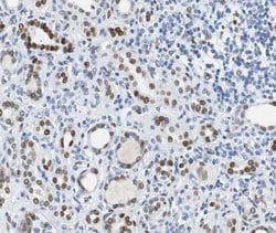 Invitrogen Phospho-BRCA1 (Ser1524) Polyclonal Antibody 100 &mu;L; Unconjugated:Antibodies,