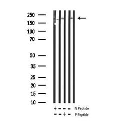 Invitrogen Phospho-BRCA1 (Ser1524) Polyclonal Antibody 100 &mu;L; Unconjugated:Antibodies,