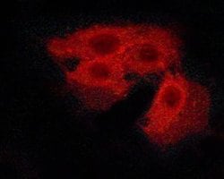 Invitrogen Phospho-Calcium Sensing Receptor (Thr888) Polyclonal Antibody