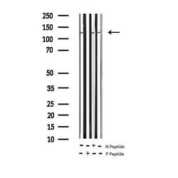 Invitrogen Phospho-Calcium Sensing Receptor (Thr888) Polyclonal Antibody