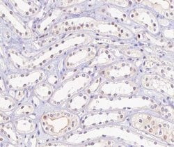 Invitrogen Phospho-HNF4A (Ser313) Polyclonal Antibody 100 &mu;L; Unconjugated:Antibodies,