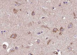 Invitrogen Phospho-TPL2 (Thr290) Polyclonal Antibody 100 &mu;L; Unconjugated:Antibodies,