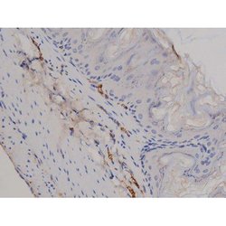 Invitrogen Phospho-STAT6 (Tyr641) Polyclonal Antibody 100 &mu;L | Buy Online | Invitrogen&trade; | Fisher Scientific