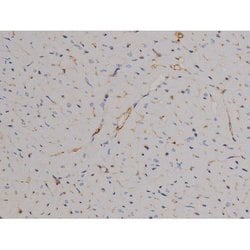 Invitrogen Phospho-STAT6 (Tyr641) Polyclonal Antibody 100 &mu;L | Buy Online | Invitrogen&trade; | Fisher Scientific