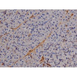 Invitrogen Phospho-STAT6 (Tyr641) Polyclonal Antibody 100 &mu;L | Buy Online | Invitrogen&trade; | Fisher Scientific