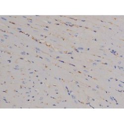 Invitrogen Phospho-STAT6 (Tyr641) Polyclonal Antibody 100 &mu;L | Buy Online | Invitrogen&trade; | Fisher Scientific