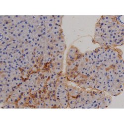 Invitrogen Phospho-STAT6 (Tyr641) Polyclonal Antibody 100 &mu;L | Buy Online | Invitrogen&trade; | Fisher Scientific