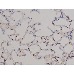 Invitrogen Phospho-STAT6 (Tyr641) Polyclonal Antibody 100 &mu;L | Buy Online | Invitrogen&trade; | Fisher Scientific