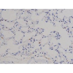 Invitrogen Phospho-STAT6 (Thr645) Polyclonal Antibody 100 &mu;L; Unconjugated:Antibodies,