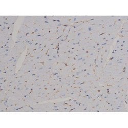 Invitrogen Phospho-STAT6 (Thr645) Polyclonal Antibody 100 &mu;L; Unconjugated:Antibodies,