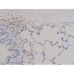 Invitrogen Phospho-STAT6 (Thr645) Polyclonal Antibody 100 &mu;L; Unconjugated:Antibodies,