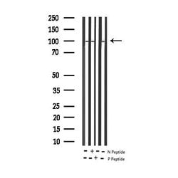Invitrogen Phospho-STAT6 (Thr645) Polyclonal Antibody 100 &mu;L; Unconjugated:Antibodies,