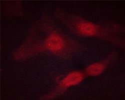 Invitrogen Phospho-STAT5 alpha/beta (Ser726, Ser731) Polyclonal Antibody 100 &mu;L | Buy Online | Invitrogen&trade; | Fisher Scientific