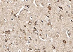 Invitrogen Phospho-GluR1 (Ser863) Polyclonal Antibody 100 &mu;L; Unconjugated:Antibodies,