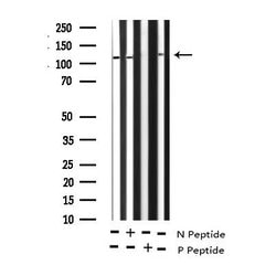 Invitrogen Phospho-GluR1 (Ser863) Polyclonal Antibody 100 &mu;L; Unconjugated:Antibodies,
