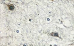 Invitrogen Phospho-mTOR (Ser2481) Polyclonal Antibody 100 μL; Unconjugated:Antibodies,