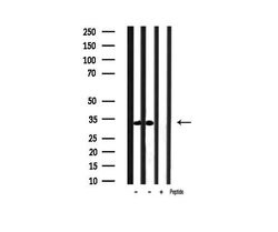 Invitrogen Phospho-Caspase 3 (Ser150) Polyclonal Antibody 100 &mu;L | Buy Online | Invitrogen&trade; | Fisher Scientific