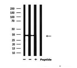 Invitrogen Phospho-Caspase 3 (Ser150) Polyclonal Antibody 100 &mu;L | Buy Online | Invitrogen&trade; | Fisher Scientific