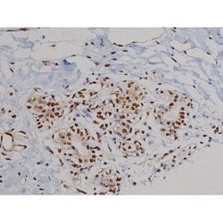 Invitrogen Phospho-ZAP-70 (Tyr319) Polyclonal Antibody 100 &mu;L; Unconjugated:Antibodies,