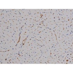 Invitrogen Phospho-ZAP-70 (Tyr319) Polyclonal Antibody 100 &mu;L; Unconjugated:Antibodies,