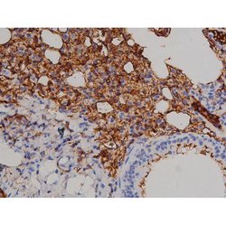 Invitrogen Phospho-ZAP-70 (Tyr319) Polyclonal Antibody 100 &mu;L; Unconjugated:Antibodies,