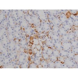 Invitrogen Phospho-ZAP-70 (Tyr319) Polyclonal Antibody 100 &mu;L; Unconjugated:Antibodies,