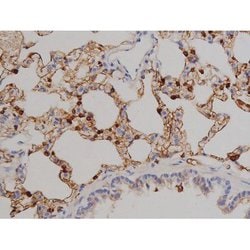 Invitrogen Phospho-ZAP-70 (Tyr319) Polyclonal Antibody 100 &mu;L; Unconjugated:Antibodies,
