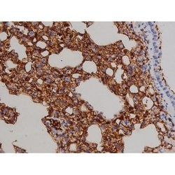 Invitrogen Phospho-ZAP-70 (Tyr319) Polyclonal Antibody 100 &mu;L; Unconjugated:Antibodies,