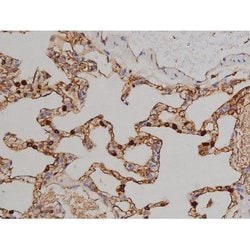 Invitrogen Phospho-ZAP-70 (Tyr319) Polyclonal Antibody 100 &mu;L; Unconjugated:Antibodies,