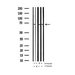 Invitrogen Phospho-ZAP-70 (Tyr319) Polyclonal Antibody 100 &mu;L; Unconjugated:Antibodies,