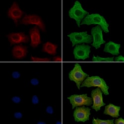 Invitrogen Phospho-ZAP-70 (Tyr319) Polyclonal Antibody 100 &mu;L; Unconjugated:Antibodies,