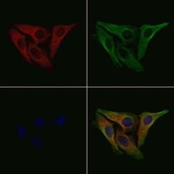 Invitrogen Phospho-ZAP-70 (Tyr493) Polyclonal Antibody 100 &mu;L; Unconjugated:Antibodies,