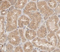 Invitrogen Phospho-ZAP-70 (Tyr493) Polyclonal Antibody 100 &mu;L; Unconjugated:Antibodies,