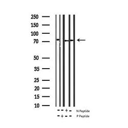 Invitrogen Phospho-ZAP-70 (Tyr493) Polyclonal Antibody 100 &mu;L; Unconjugated:Antibodies,