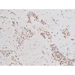 Invitrogen Phospho-SYK (Tyr348) Polyclonal Antibody 100 &mu;L | Buy Online | Invitrogen&trade; | Fisher Scientific