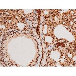 Invitrogen Phospho-SYK (Tyr348) Polyclonal Antibody 100 &mu;L | Buy Online | Invitrogen&trade; | Fisher Scientific