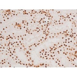 Invitrogen Phospho-SYK (Tyr348) Polyclonal Antibody 100 &mu;L | Buy Online | Invitrogen&trade; | Fisher Scientific