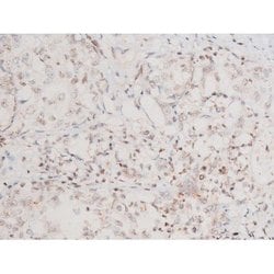 Invitrogen Phospho-SYK (Tyr348) Polyclonal Antibody 100 &mu;L | Buy Online | Invitrogen&trade; | Fisher Scientific